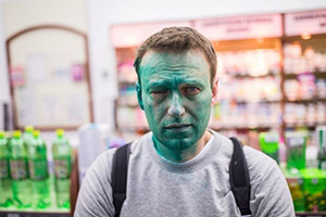 Алексей Навальный с тяжелым ожогом глаза